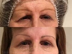 Image result for Cat Eyebrow Lift