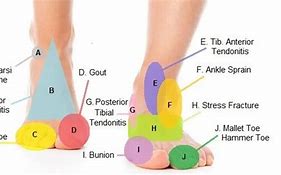 Image result for Anatomy of Foot Pain Top