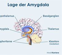 Image result for Magdalay Amygdala