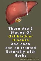 Image result for Infected Gallbladder
