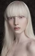 Image result for Most Beautiful Albino