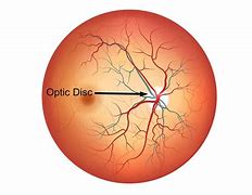 Image result for Eye Anatomy Optic Disc