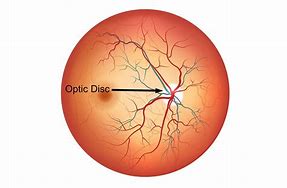 Image result for optical disc