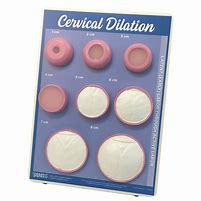 Image result for Cervical Dilation Chart Plastic