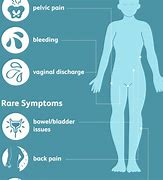 Image result for Cervix Pain