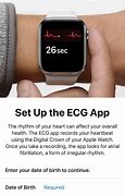 Image result for Apple Watch ECG 512Hz