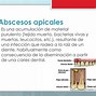 Image result for absyinencia