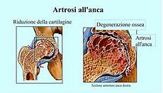 dolore parte interna ginocchio sinistro dolore all inguine destro o sinistro e gamba coscia dolore parte interna ginocchio sinistro dolore all inguine destro o sinistro e gamba coscia
