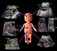 Image result for Obstetric Ultrasonography