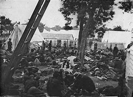 Image result for Civil War Syphilis