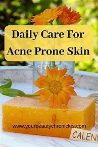 Image result for Dehydrated Skin Acne