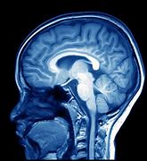 Image result for Brain Uncaged