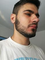 Image result for Growing a Patchy Beard