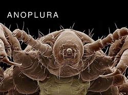 Image result for Anoplura