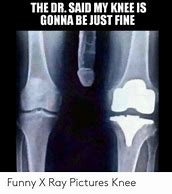 Image result for Knee X-ray Meme