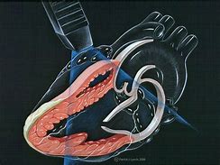 Image result for Illustration Cardiac Echocardiogram