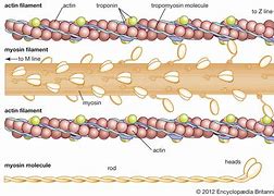 Image result for actin�gravo