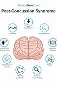 Image result for Concussion Memory Loss