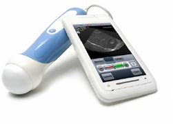 Image result for Smartphone Medical Device