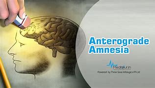Image result for Anterograde Amnesia