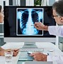 Image result for Stage 3 Lung Cancer Prognosis