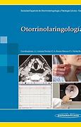 Image result for otorrinolaringolog�a