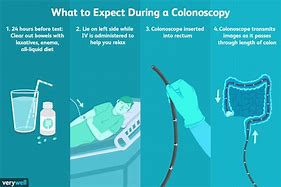 Image result for Colon Polyps Colonoscopy