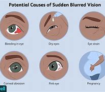 Image result for Central Blurry Vision