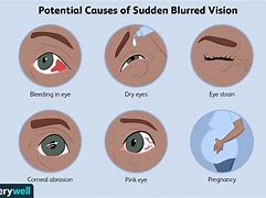 Image result for Peripheral Vision Blurry