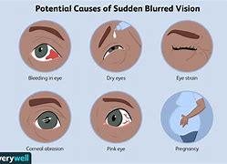 Image result for Blurry Vision Screen
