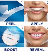 Image result for Whitening Strips for Teeth Ads Image