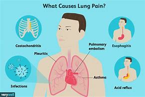 Image result for Lung Cancer Back Pain