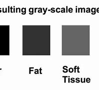 Image result for X-ray Technique Chart