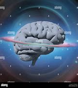 Image result for Super Brain Atomsphere