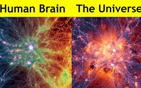 Image result for Brain Looks Like Universe