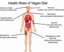 Image result for Complications of Vegan Diet