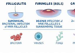 Image result for Molluscum vs Folliculitis