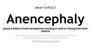 Image result for Anencephaly