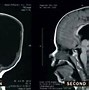 Image result for Born Withot a Brain