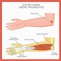 Image result for Elbow Physical Therapy Exercises