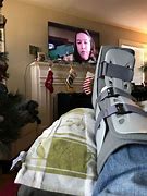 Image result for Foot Surgery Memes