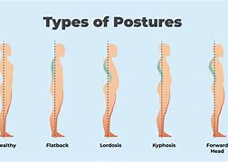 Image result for Abnormal Posture