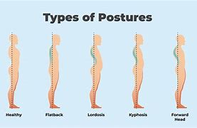 Image result for Poor Posture