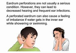 Image result for Ear Cut