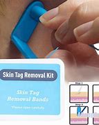 Image result for Skin Tag Removal Pads