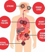 Image result for Facts About Heart Disease