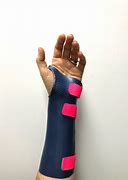 Image result for Waterproof Arm Cast