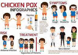Image result for Chickenpox Mode of Transmission