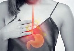 Image result for Acid Reflux and Jaw Pain
