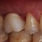 Image result for 8002A Tooth